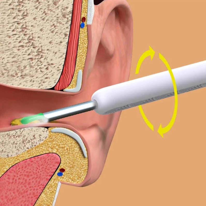 Limpiador de Oidos con Camara WIFI Recargable